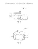 DIRECT FABRICATION OF ORTHODONTIC APPLIANCES WITH VARIABLE PROPERTIES diagram and image