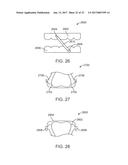 DIRECT FABRICATION OF ORTHODONTIC APPLIANCES WITH VARIABLE PROPERTIES diagram and image