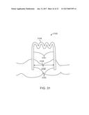 DIRECT FABRICATION OF ORTHODONTIC APPLIANCES WITH VARIABLE PROPERTIES diagram and image