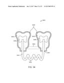 DIRECT FABRICATION OF ORTHODONTIC APPLIANCES WITH VARIABLE PROPERTIES diagram and image