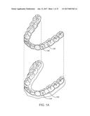 SYSTEMS, APPARATUSES AND METHODS FOR DENTAL APPLIANCES WITH INTEGRALLY     FORMED FEATURES diagram and image