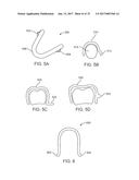 SYSTEMS, APPARATUSES AND METHODS FOR DENTAL APPLIANCES WITH INTEGRALLY     FORMED FEATURES diagram and image