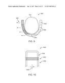 SYSTEMS, APPARATUSES AND METHODS FOR DENTAL APPLIANCES WITH INTEGRALLY     FORMED FEATURES diagram and image