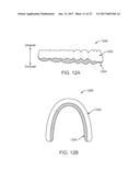 SYSTEMS, APPARATUSES AND METHODS FOR DENTAL APPLIANCES WITH INTEGRALLY     FORMED FEATURES diagram and image