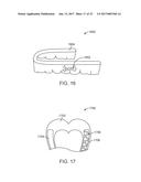 SYSTEMS, APPARATUSES AND METHODS FOR DENTAL APPLIANCES WITH INTEGRALLY     FORMED FEATURES diagram and image
