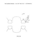 SYSTEMS, APPARATUSES AND METHODS FOR DENTAL APPLIANCES WITH INTEGRALLY     FORMED FEATURES diagram and image