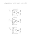 SYSTEMS, APPARATUSES AND METHODS FOR DENTAL APPLIANCES WITH INTEGRALLY     FORMED FEATURES diagram and image