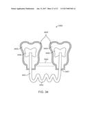 SYSTEMS, APPARATUSES AND METHODS FOR DENTAL APPLIANCES WITH INTEGRALLY     FORMED FEATURES diagram and image