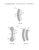 MULTI-MATERIAL ALIGNERS diagram and image