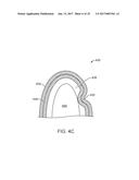 MULTI-MATERIAL ALIGNERS diagram and image