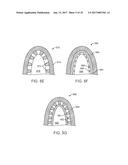 MULTI-MATERIAL ALIGNERS diagram and image