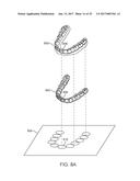 MULTI-MATERIAL ALIGNERS diagram and image