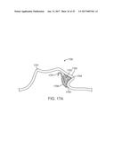 MULTI-MATERIAL ALIGNERS diagram and image