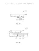 DIRECT FABRICATION OF POWER ARMS diagram and image