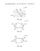 DIRECT FABRICATION OF POWER ARMS diagram and image