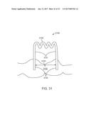 DIRECT FABRICATION OF POWER ARMS diagram and image