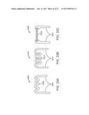 DIRECT FABRICATION OF POWER ARMS diagram and image