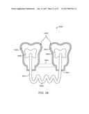 DIRECT FABRICATION OF POWER ARMS diagram and image