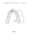 DUAL ALIGNER ASSEMBLY diagram and image