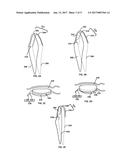 DUAL ALIGNER ASSEMBLY diagram and image