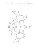 DIRECT FABRICATION OF ALIGNERS FOR ARCH EXPANSION diagram and image