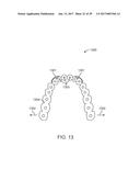 DIRECT FABRICATION OF ALIGNERS FOR ARCH EXPANSION diagram and image