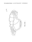 DIRECT FABRICATION OF ALIGNERS FOR ARCH EXPANSION diagram and image