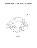 DIRECT FABRICATION OF ALIGNERS FOR ARCH EXPANSION diagram and image