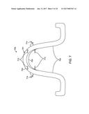 DIRECT FABRICATION OF ALIGNERS FOR PALATE EXPANSION AND OTHER APPLICATIONS diagram and image