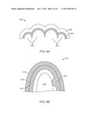 DIRECT FABRICATION OF ATTACHMENT TEMPLATES WITH ADHESIVE diagram and image