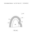 DIRECT FABRICATION OF ATTACHMENT TEMPLATES WITH ADHESIVE diagram and image