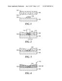 BONDABLE DENTAL ASSEMBLIES AND METHODS INCLUDING A COMPRESSIBLE MATERIAL diagram and image