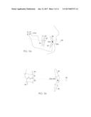 METHOD OF DESIGNING A MANDIBULAR ADVANCEMENT DEVICE AND MANDIBULAR     ADVANCEMENT DEVICE diagram and image