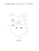 METHOD OF DESIGNING A MANDIBULAR ADVANCEMENT DEVICE AND MANDIBULAR     ADVANCEMENT DEVICE diagram and image