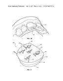 METHODS FOR TAKING AN IMPRESSION OR SCANNING WITHOUT REQUIRING REMOVAL OF     A TEMPORARY HEALING ABUTMENT diagram and image