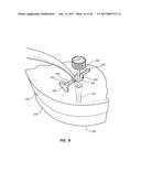 METHODS FOR TAKING AN IMPRESSION OR SCANNING WITHOUT REQUIRING REMOVAL OF     A TEMPORARY HEALING ABUTMENT diagram and image