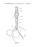 METHODS FOR TAKING AN IMPRESSION OR SCANNING WITHOUT REQUIRING REMOVAL OF     A TEMPORARY HEALING ABUTMENT diagram and image