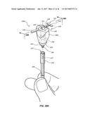 METHODS FOR TAKING AN IMPRESSION OR SCANNING WITHOUT REQUIRING REMOVAL OF     A TEMPORARY HEALING ABUTMENT diagram and image