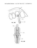 METHODS FOR TAKING AN IMPRESSION OR SCANNING WITHOUT REQUIRING REMOVAL OF     A TEMPORARY HEALING ABUTMENT diagram and image