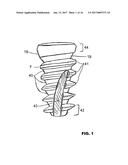 CONDENSING SKELETAL IMPLANT THAT FACILITATE INSERTIONS diagram and image