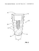 CONDENSING SKELETAL IMPLANT THAT FACILITATE INSERTIONS diagram and image