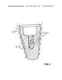 CONDENSING SKELETAL IMPLANT THAT FACILITATE INSERTIONS diagram and image