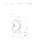 Dental Impression Acquisition Tray diagram and image