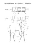 DEVICE AND METHOD FOR SUBGIGIVAL MEASUREMENT diagram and image