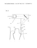 DEVICE AND METHOD FOR SUBGIGIVAL MEASUREMENT diagram and image