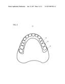 ARTIFICIAL TOOTH diagram and image