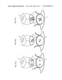 ARTIFICIAL TOOTH diagram and image