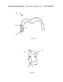 SYSTEMS, APPARATUSES AND METHODS FOR SUBSTANCE DELIVERY FROM DENTAL     APPLIANCE diagram and image