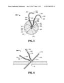 HERNIA REPAIR DEVICE AND METHOD diagram and image