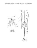 JUGULAR FEMORAL VENA CAVA FILTER SYSTEM diagram and image